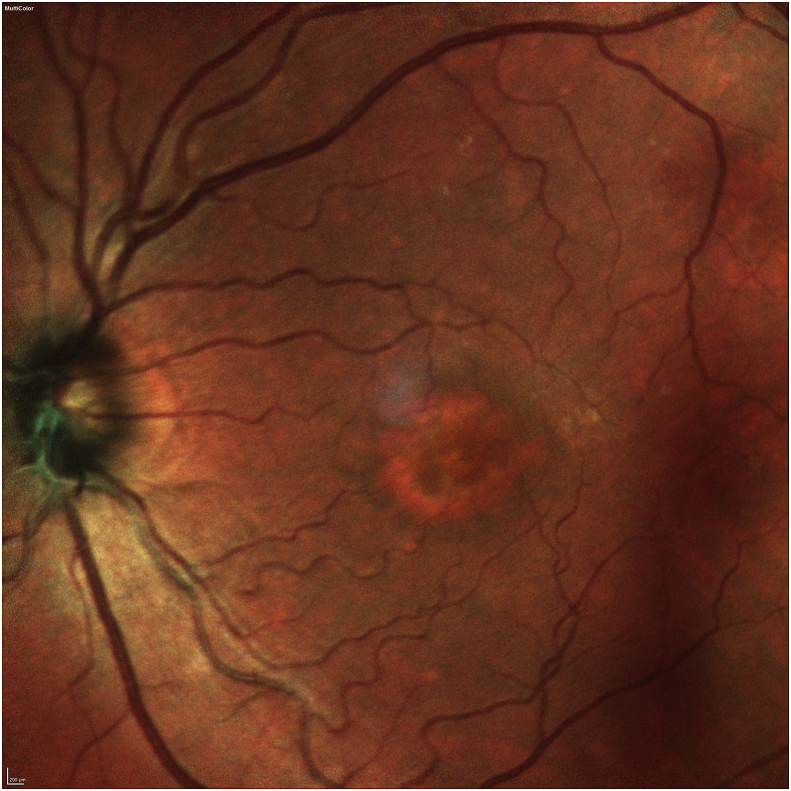 Fig. 1B