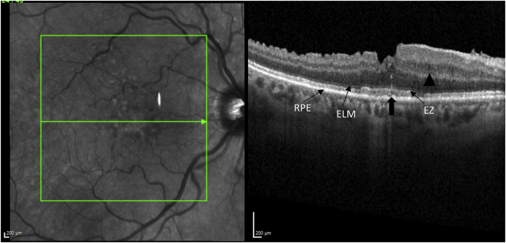 Fig. 3A