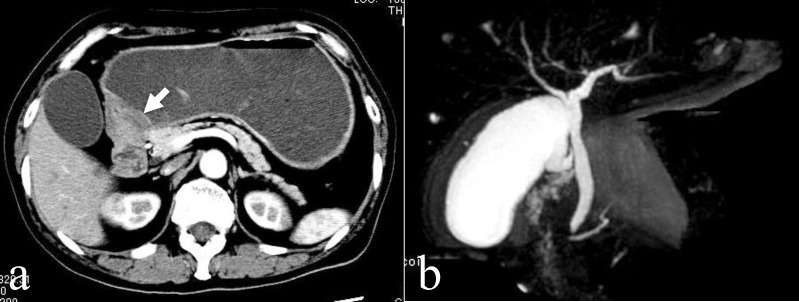 Fig. 2 