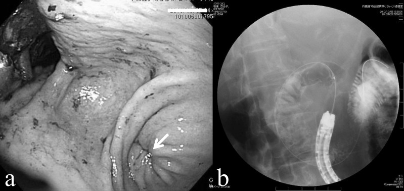 Fig. 1 