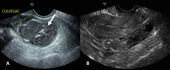 Fig 2 –