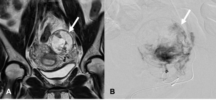 Fig 1 –