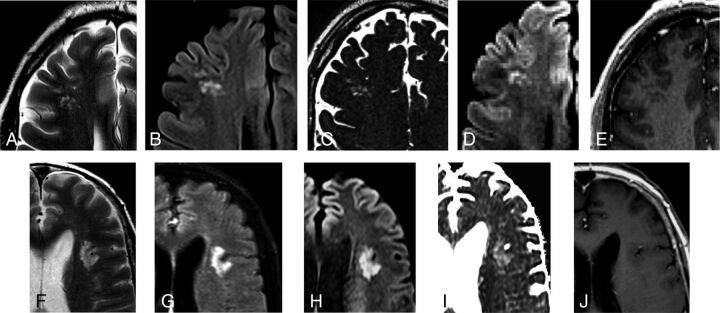 Fig 3.