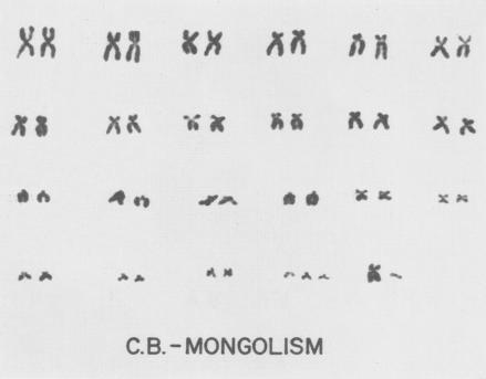 Fig. 16