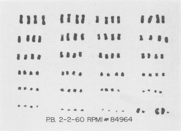 Fig. 18