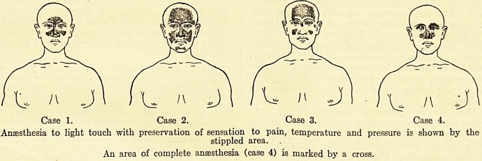 Case 1. Case 2. Case 3. Case 4.