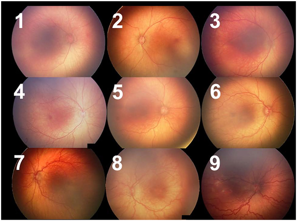 Figure 1: