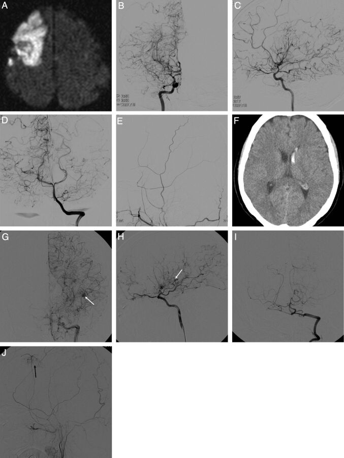 Fig 1.