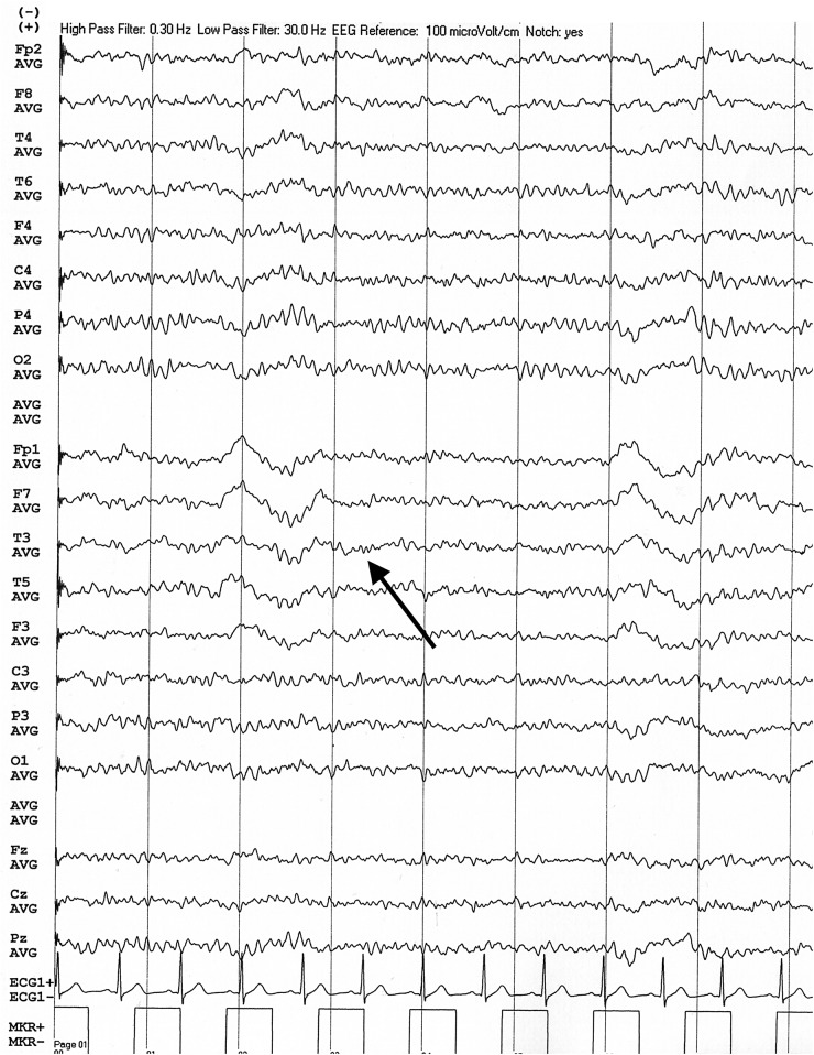 Figure 2