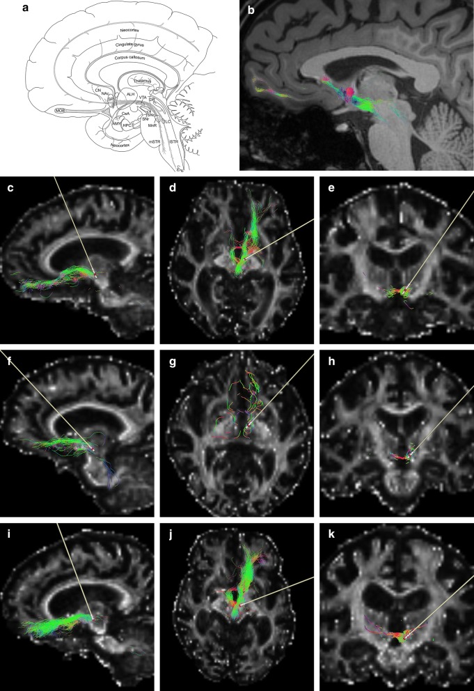 Fig. 1