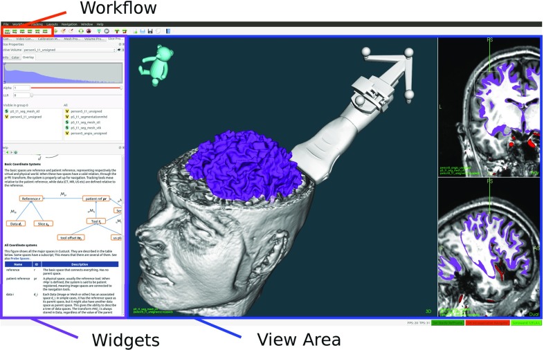 Fig. 1