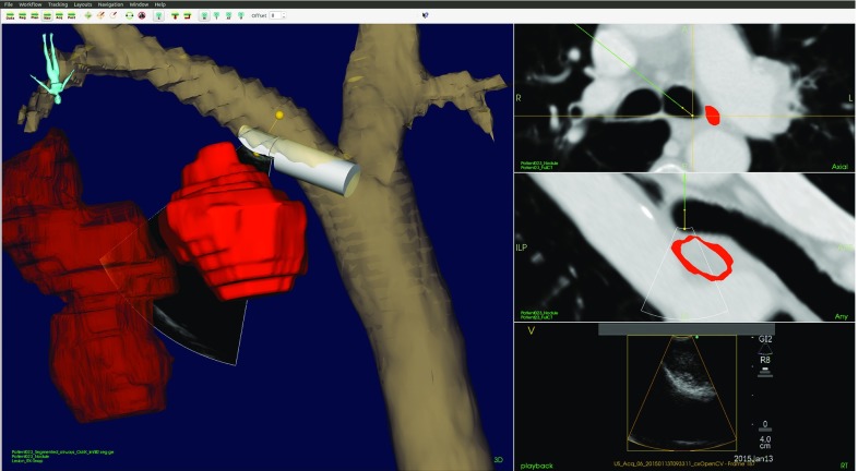 Fig. 14