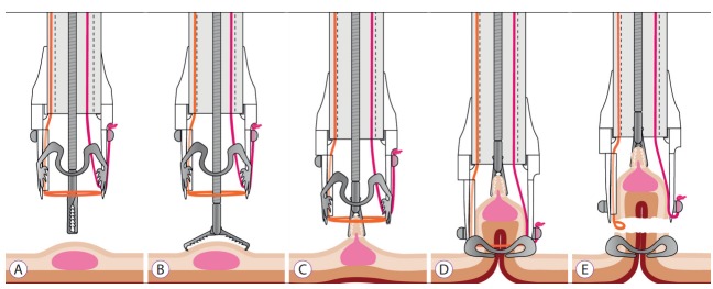 Fig. 1.