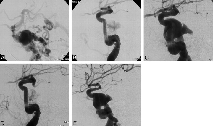 Fig 2.