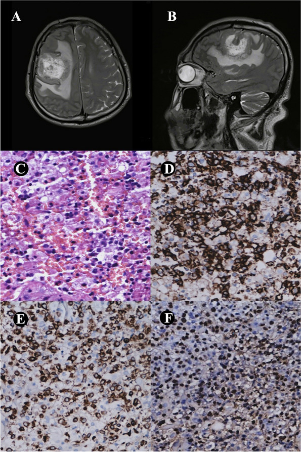 Fig. 1