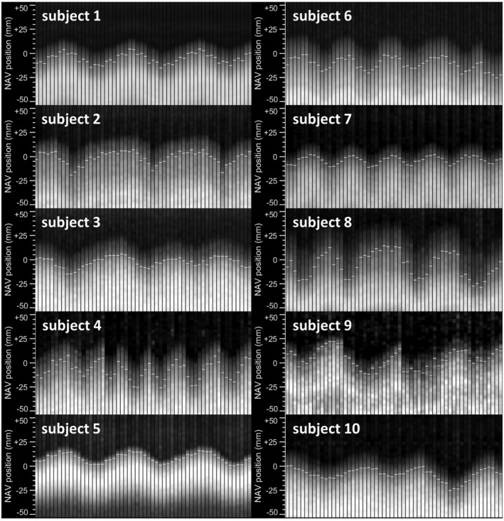 FIGURE 4