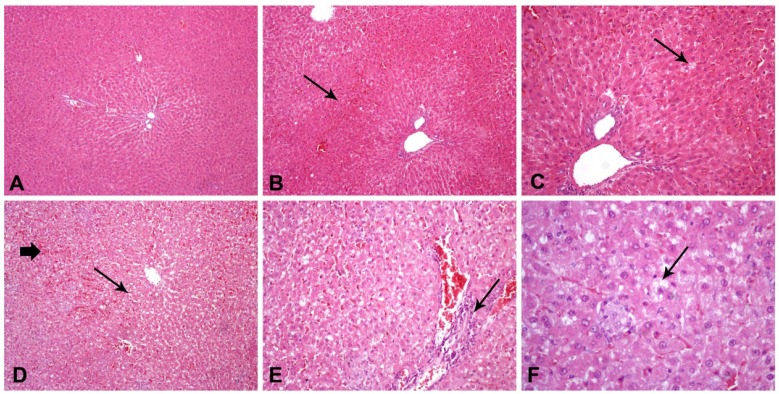 Fig. (1)