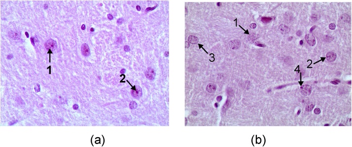 Fig. 10