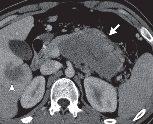 Figure 13a