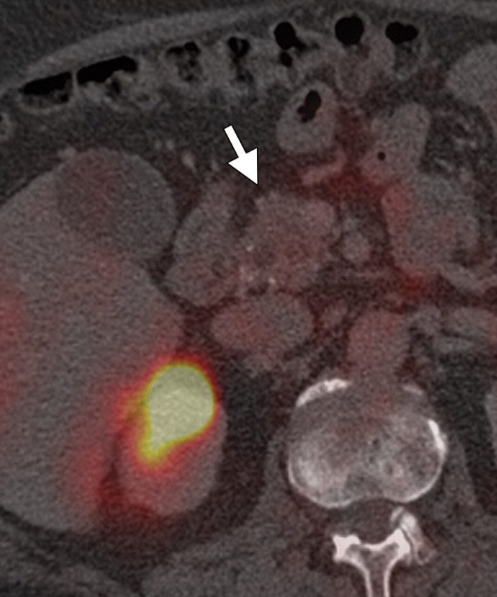 Figure 5c