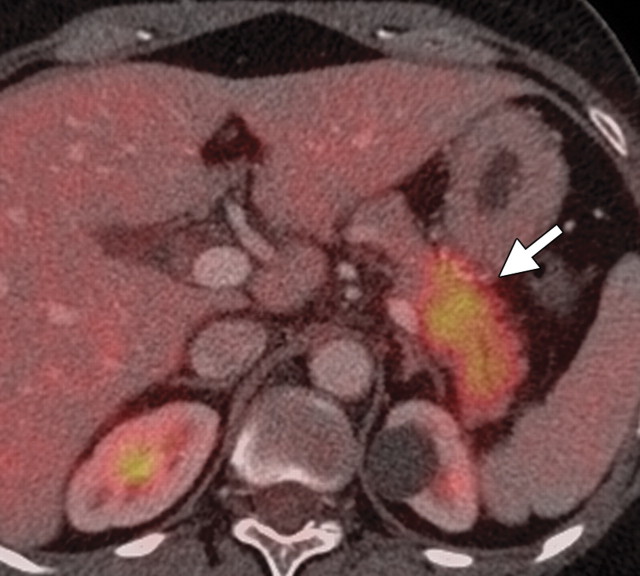 Figure 15b