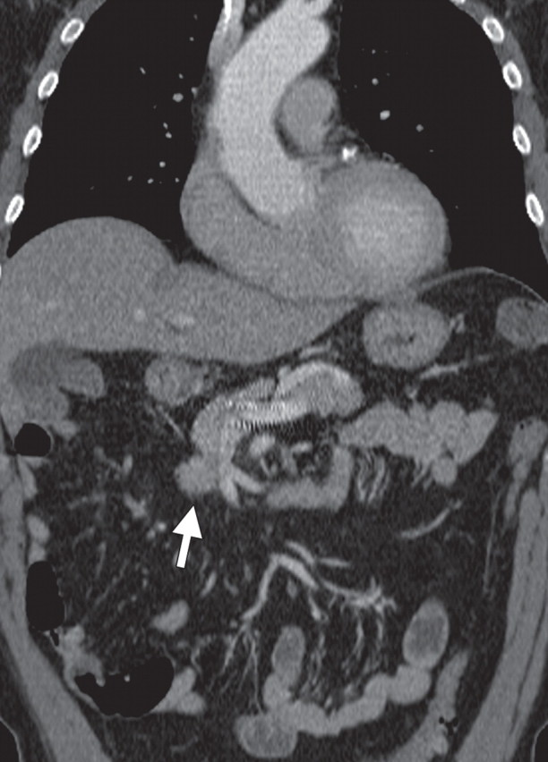 Figure 14b