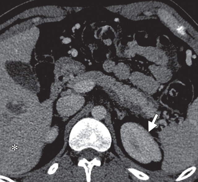 Figure 13e