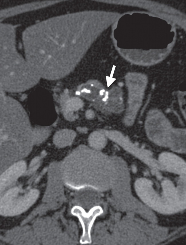 Figure 17a