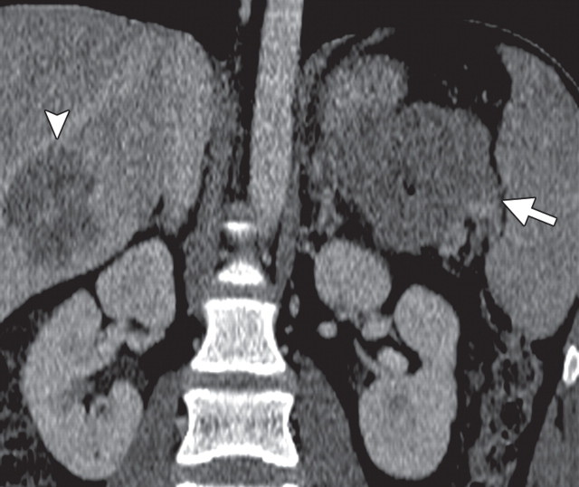 Figure 13b