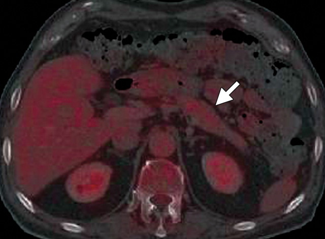 Figure 19e