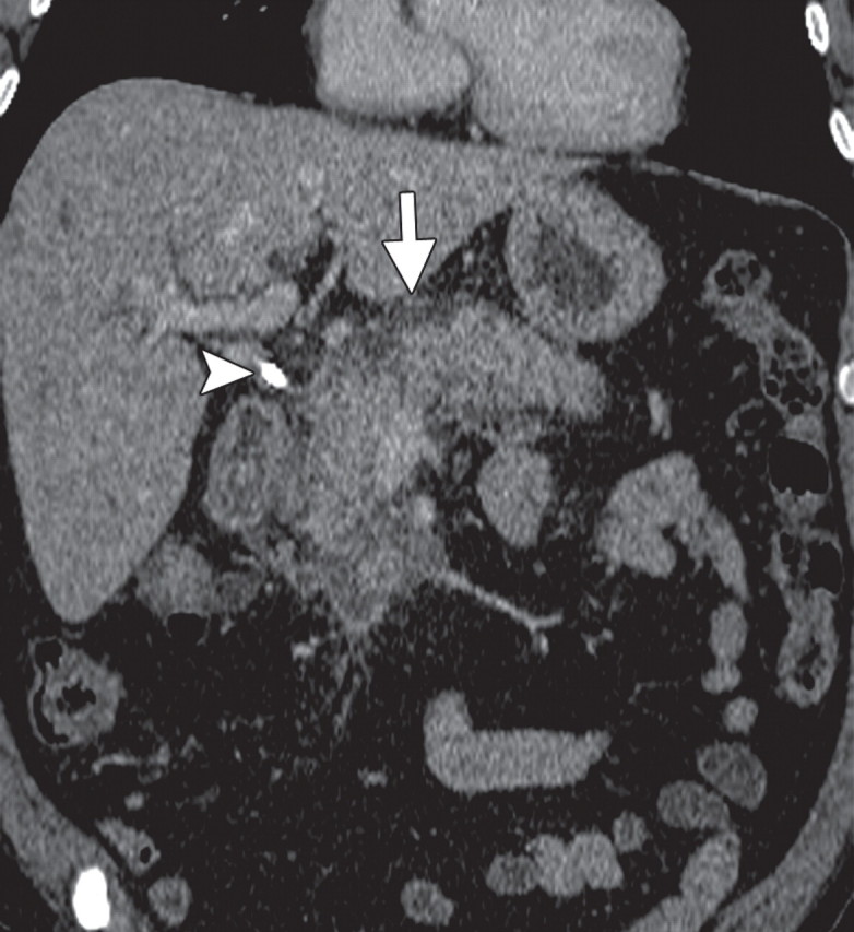 Figure 18b