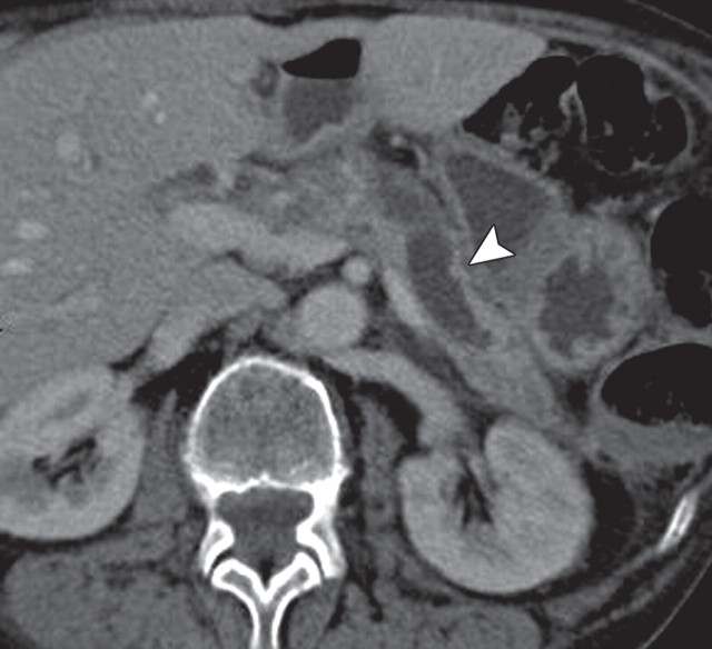 Figure 16a