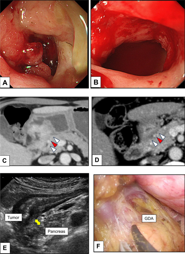 Fig. 1