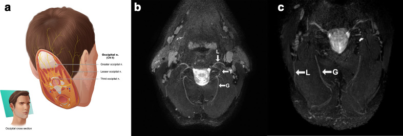 Figure 10.