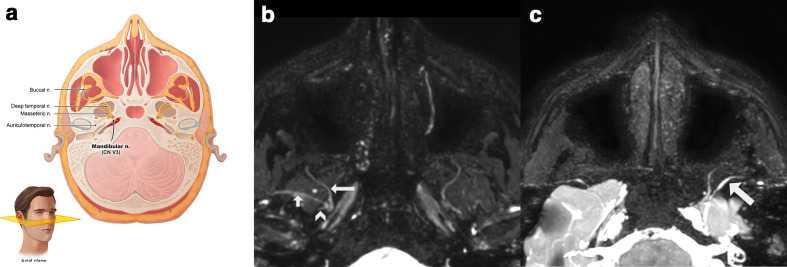 Figure 5.