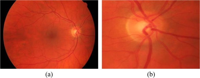 Fig. 1