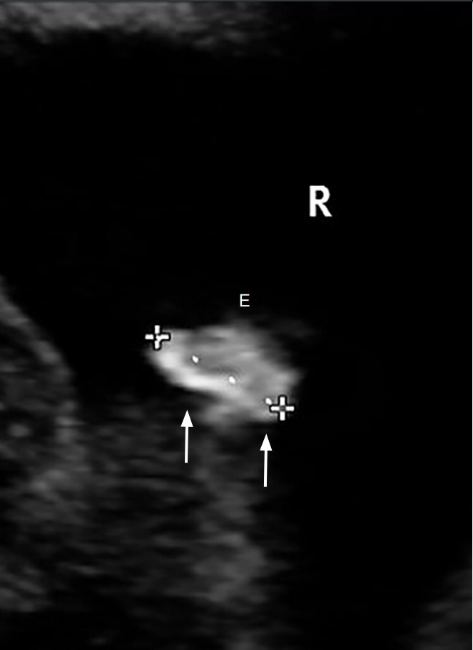 Fig. 11.