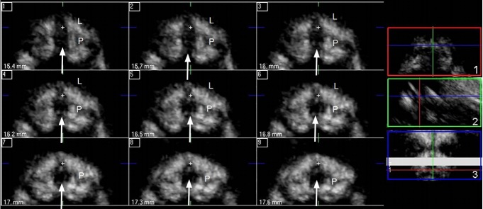 Fig. 16.