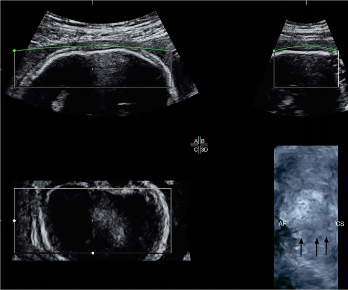 Fig. 20.