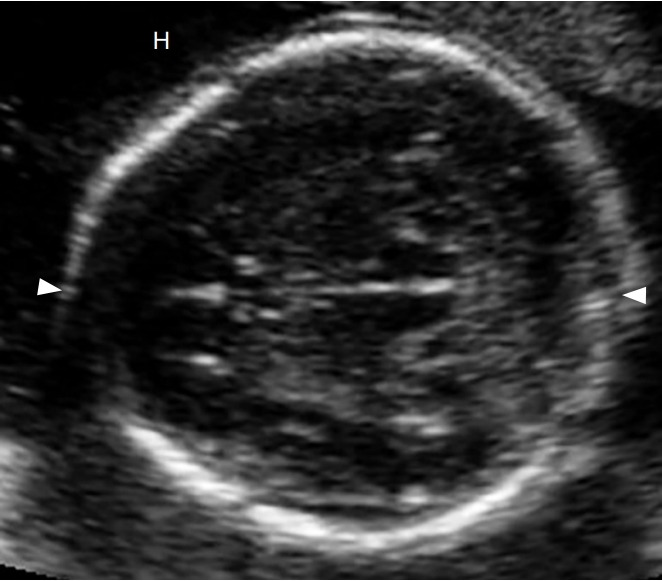 Fig. 2.