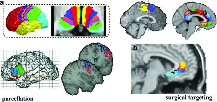 FIG. 4.