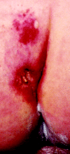 Fig 1.
