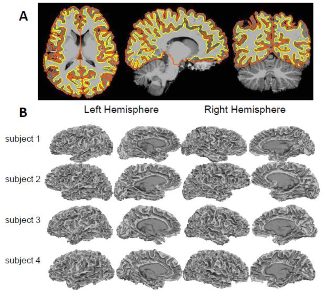 Fig. 4