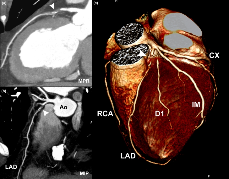 Figure 2.