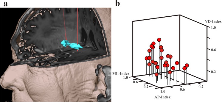 Fig 4