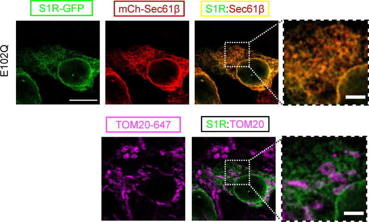 Figure 1—figure supplement 1.