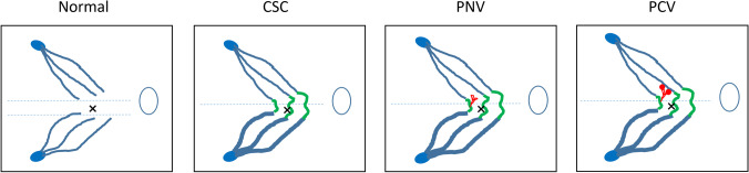 Fig. 12