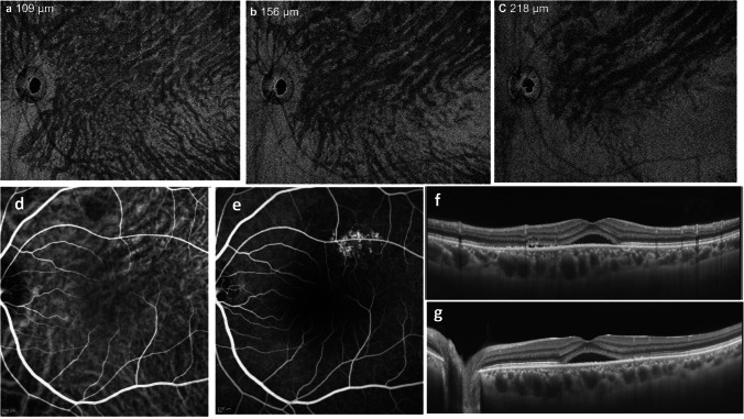 Fig. 5