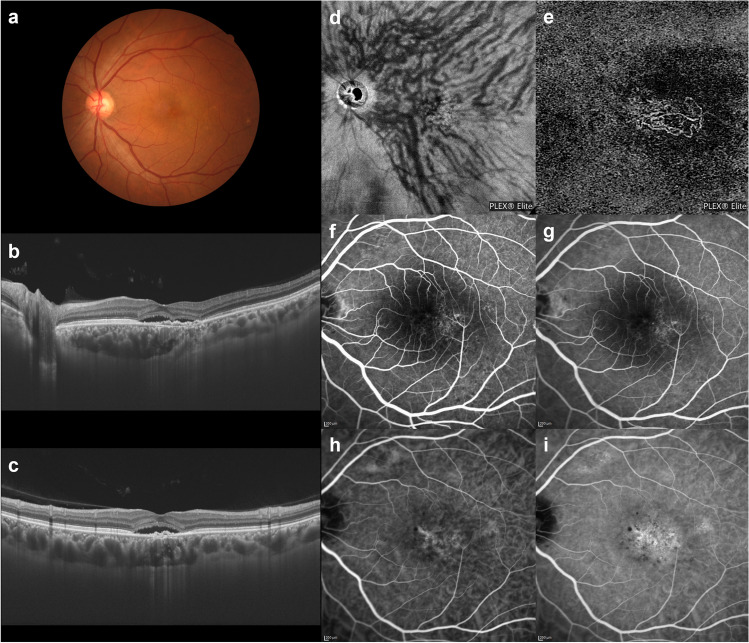 Fig. 10