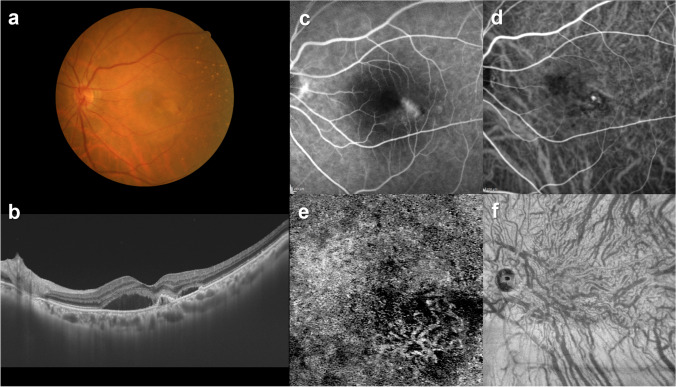 Fig. 11